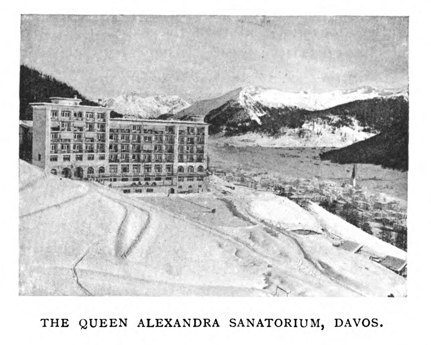 An exterior photograph of the Queen Alexandra Sanatorium in Davos, Switzerland.